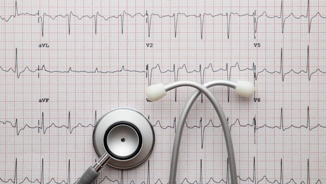 electrocardiograma y fonendo